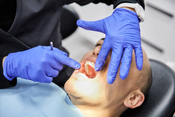 Best Emergency Tooth Extraction in Black Earth, WI